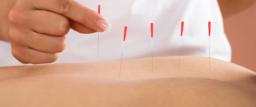 Something about Acupuncture